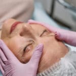 Facelift Surgery