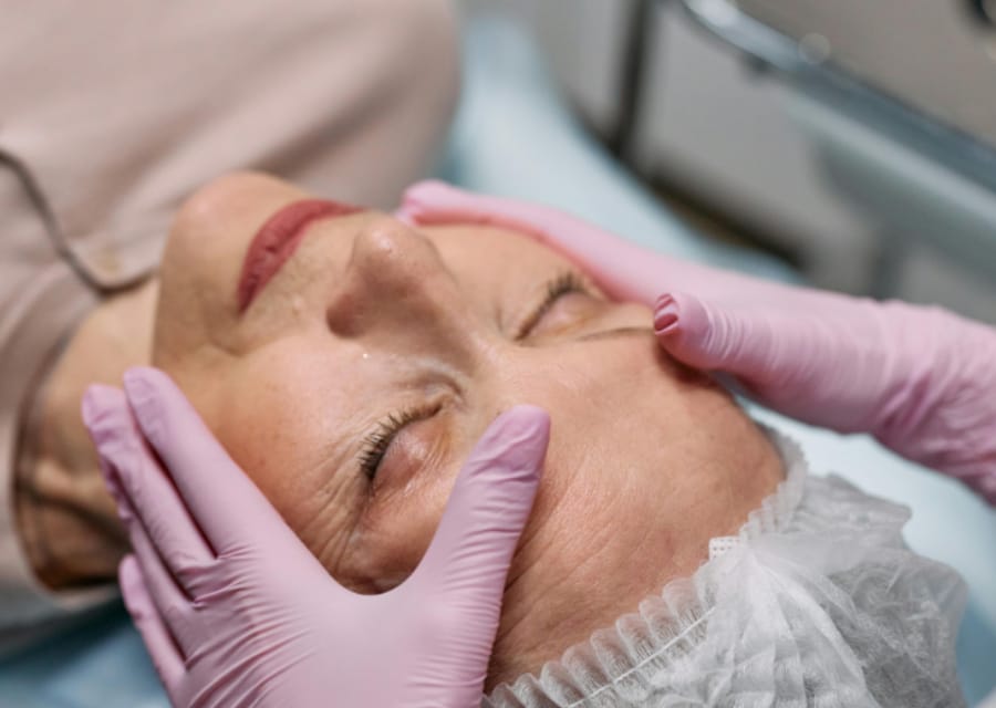 Facelift Surgery