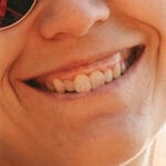Gummy Smiles