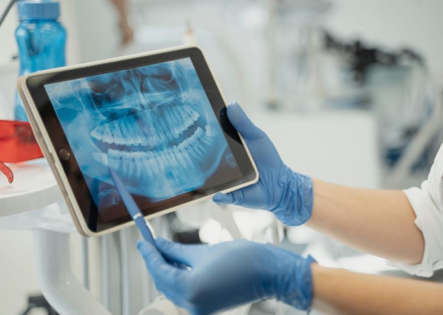 Orthognathic Surgery Orthognathic Surgery